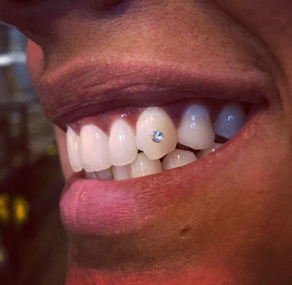 SparkleBites Professional Tooth Gem Kit