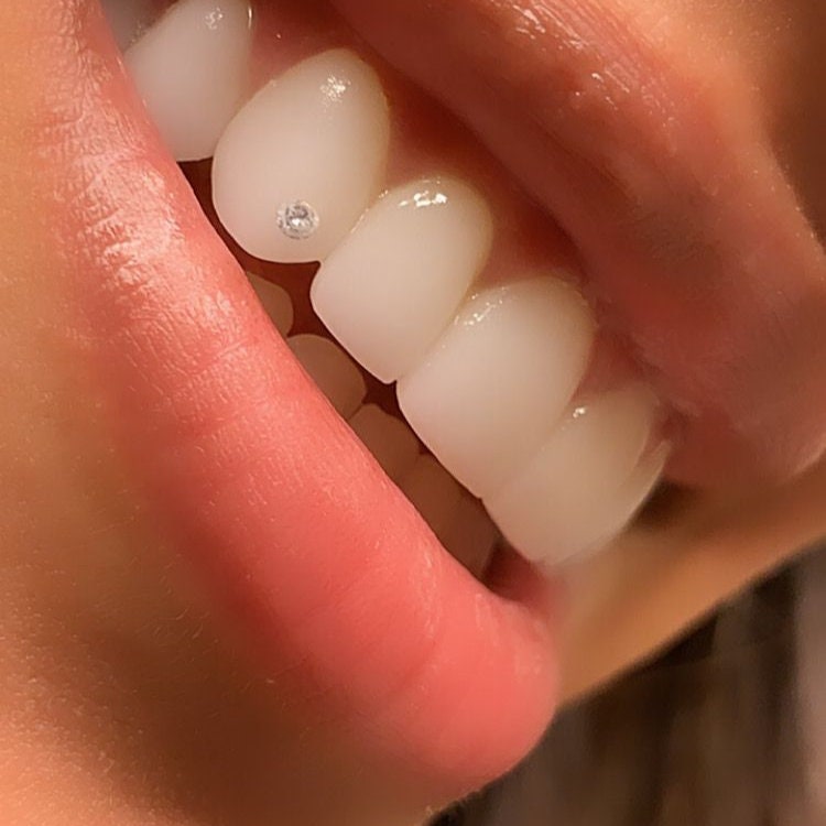 SparkleBites Professional Tooth Gem Kit